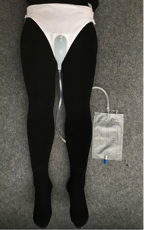 Urine Collector with Catheter and Bag